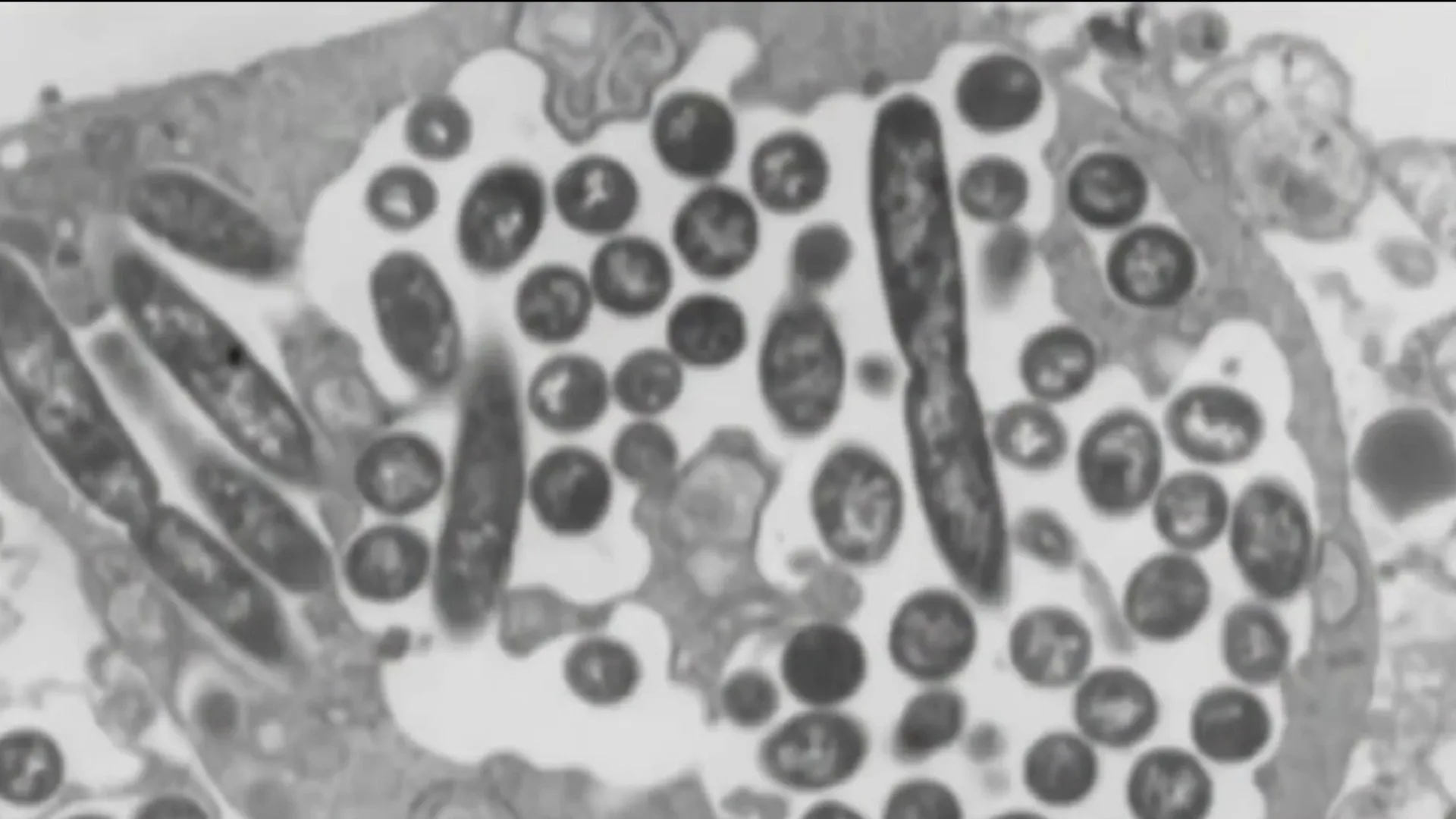 Confirman quinta muerte por legionelosis y encuentran bacterias vivas en varios edificios de NYC